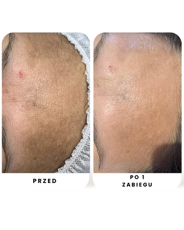 Zestaw Anti-Pigmentation VEDARA MEDICAL