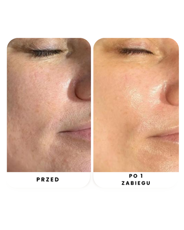 MINI ZESTAW OCZYSZCZANIA TWARZY NA ZIMNO